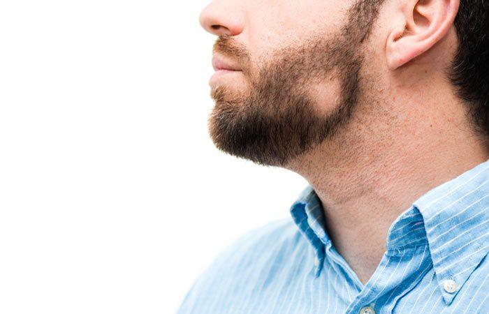 Alopecia Barbea and how to fill in a patchy beard - Hairy Man Care