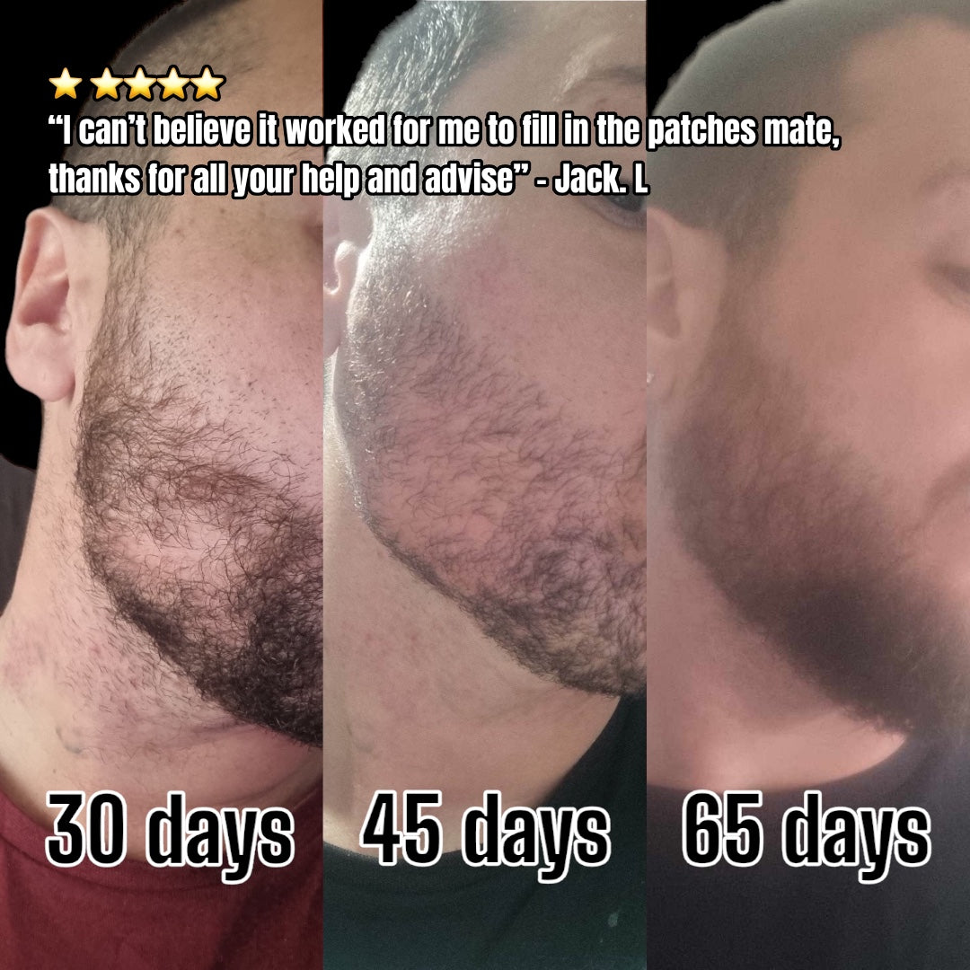 Beard Growth Kit